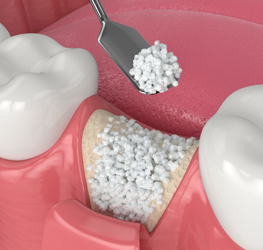 A close-up of a tooth with a toothbrush and toothpaste, representing oral hygiene in Boulder, CO.