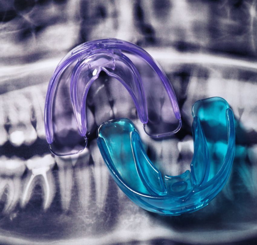 A close-up of two blue and purple dental braces on a table, highlighting orthodontic solutions in Boulder, CO.